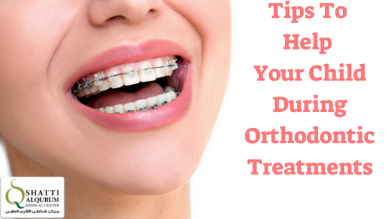Orthodontic Treatments in muscat